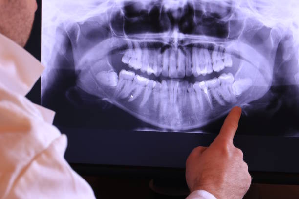 Best After-Hours Emergency Dentist in Grant City, MO