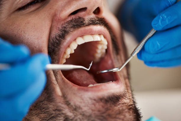 Best Emergency Broken Tooth Repair in Grant City, MO